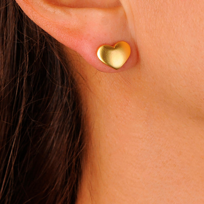 Arete Corazón